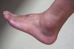 Dali, Dali Ancient City, 大理, 大理古城, 大理市第二人民医院